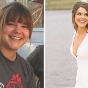 before and after weight loss